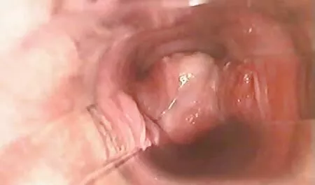 Intervju Lisa Ann filme por hd Međurasni